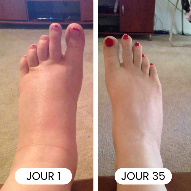 Clevao-Gouttes Drainantes Lymphatiques