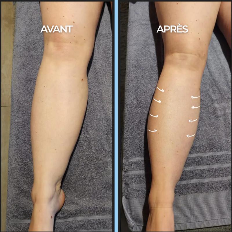 Clevao-Gouttes Drainantes Lymphatiques