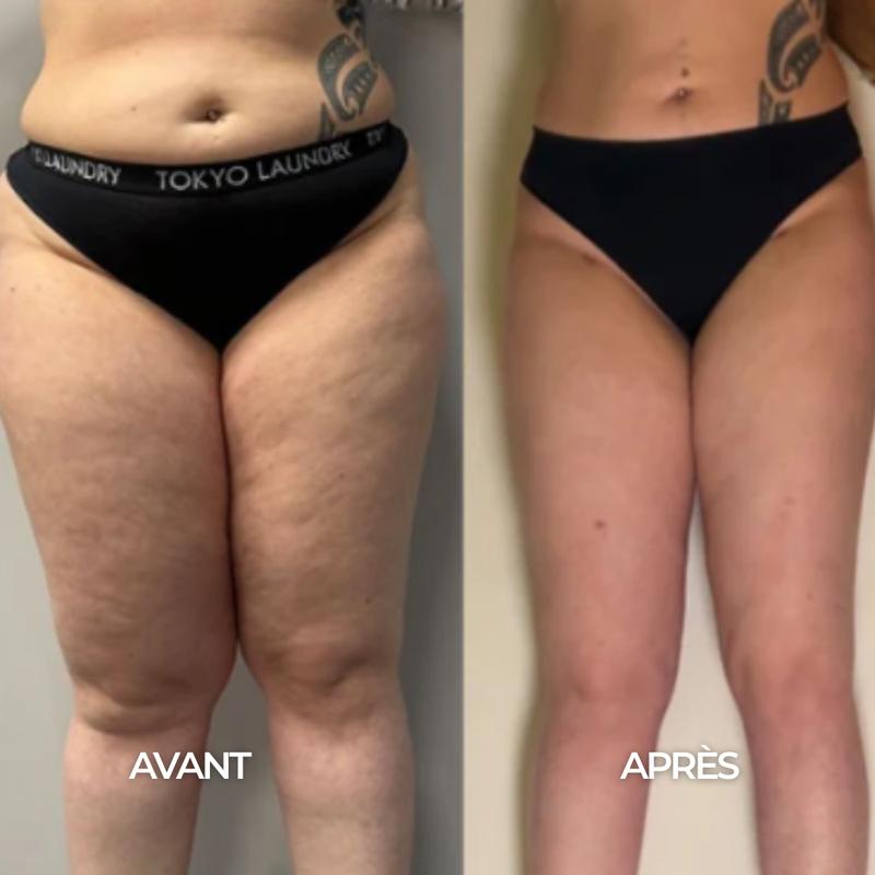 Clevao-Gouttes Drainantes Lymphatiques