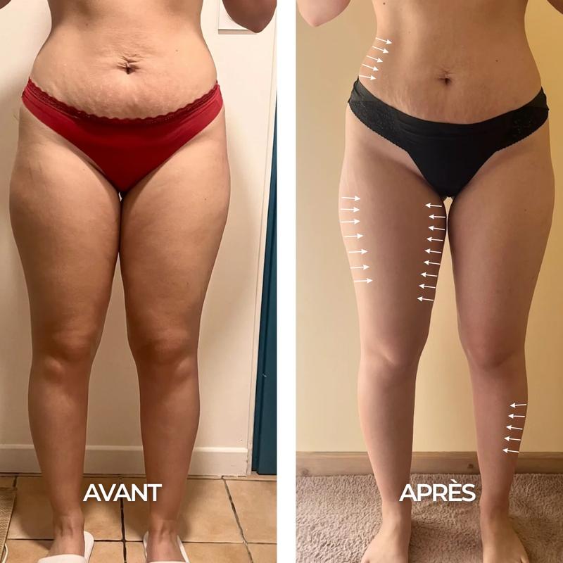 Clevao-Gouttes Drainantes Lymphatiques